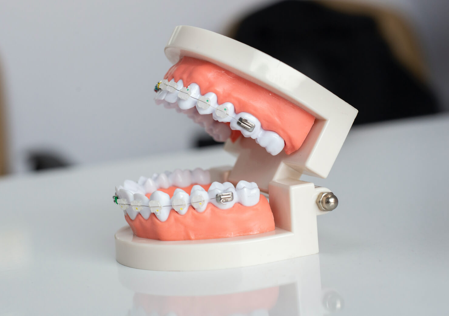 How to Have Great Oral Hygiene with Braces